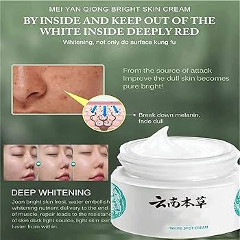 Last Day Of Discount 🔥 Japanese Melasma Cream