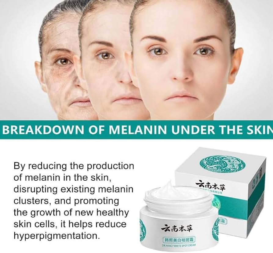 Last Day Of Discount 🔥 Japanese Melasma Cream