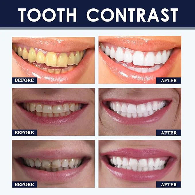 LAST DAY OF DISCOUNT🔥  Charcoal Powder for Teeth Whitening