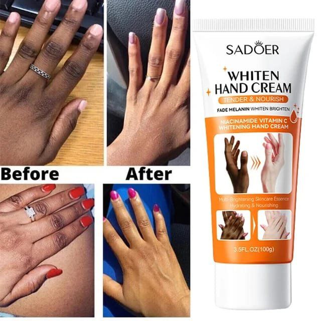 LAST DAY OF DISCOUNT 🔥 Whiten Hand Cream ( Original)